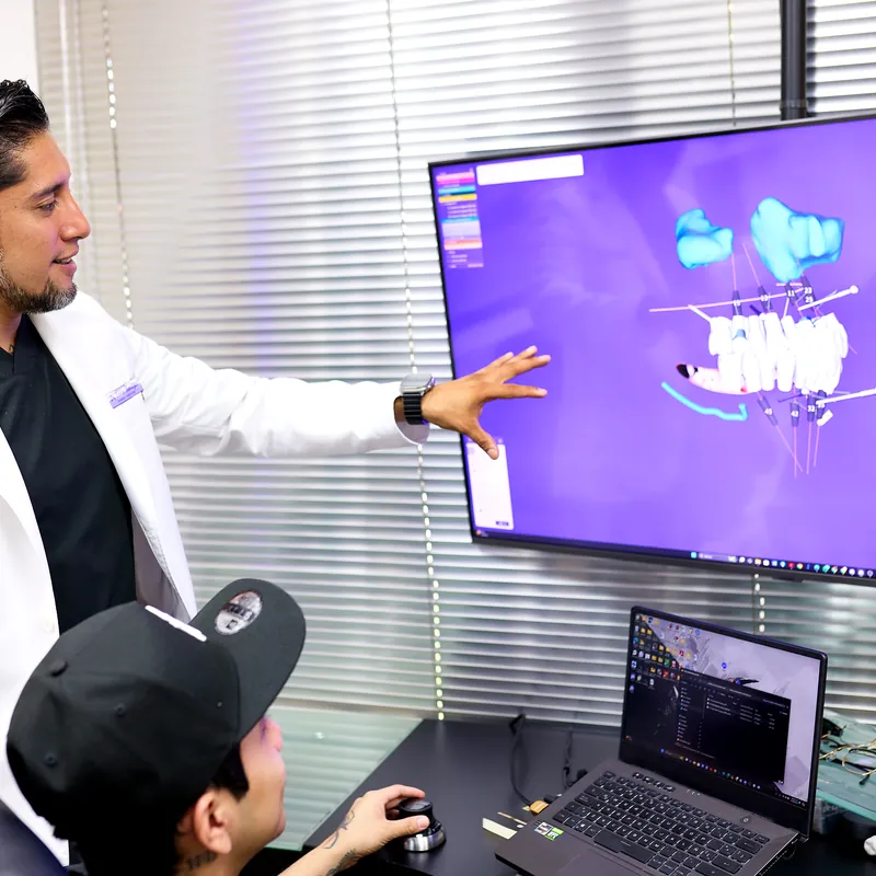 Implante dental con corona