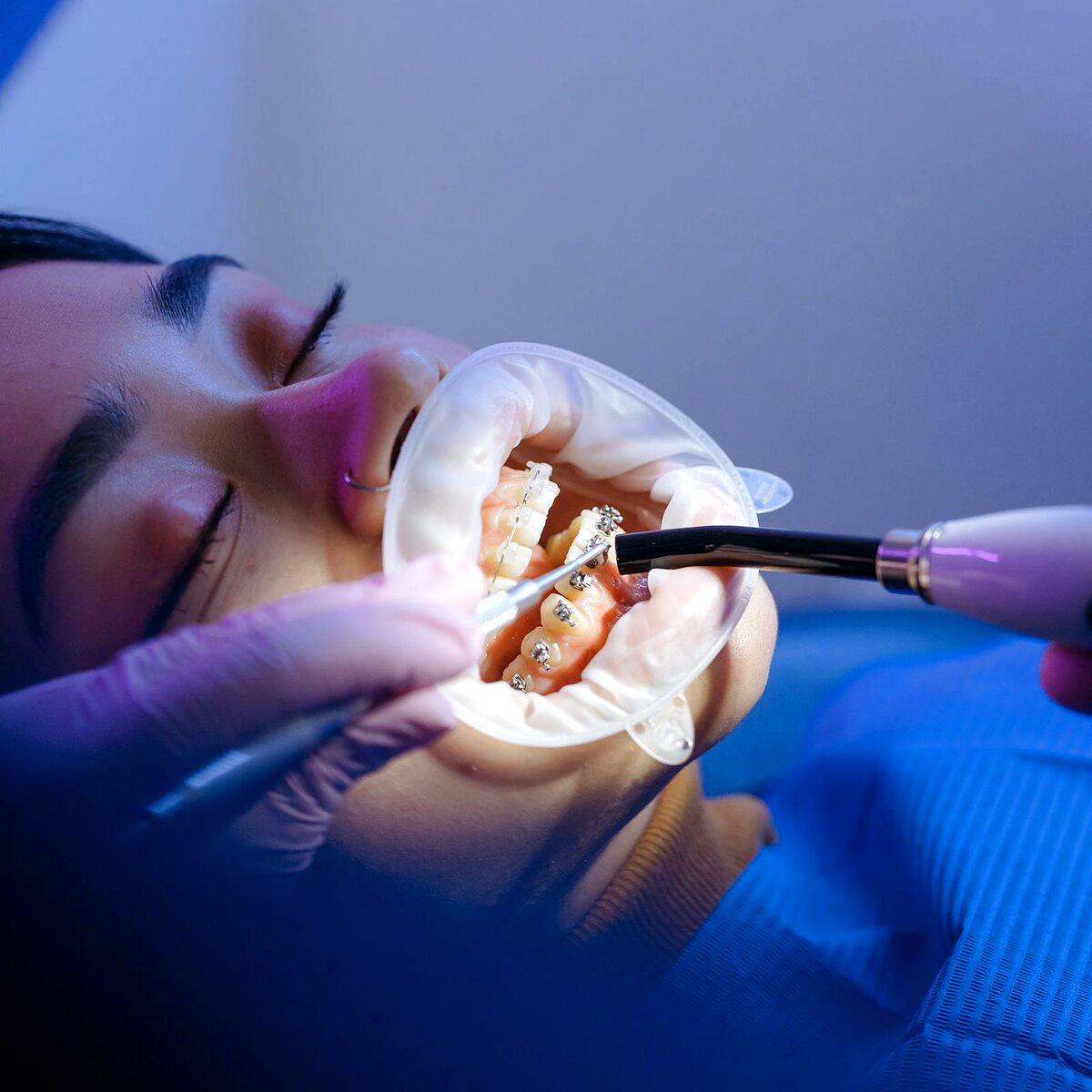 Ortodoncia en Dental Spekter Cuernavaca