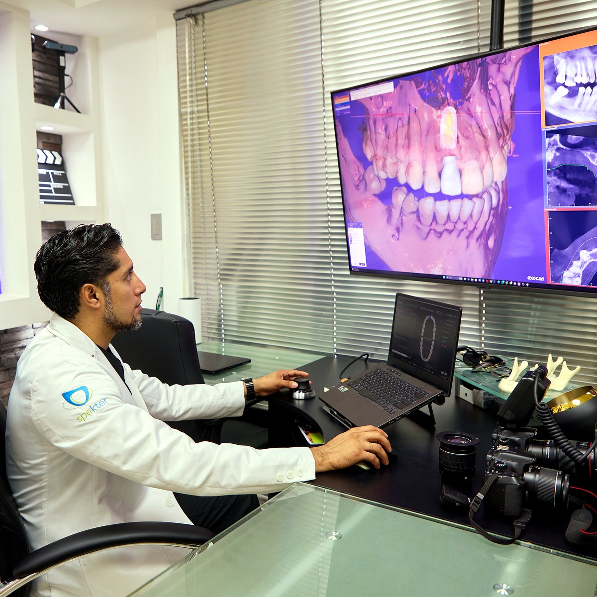 Radiografías y Tomografías en Dental Spekter Cuernavaca